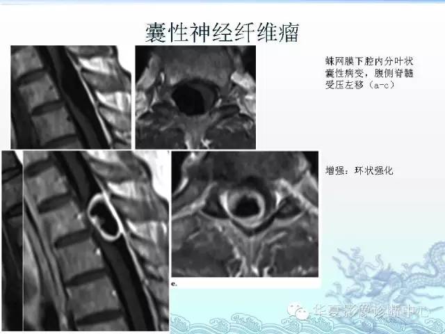 【PPT】ISCH