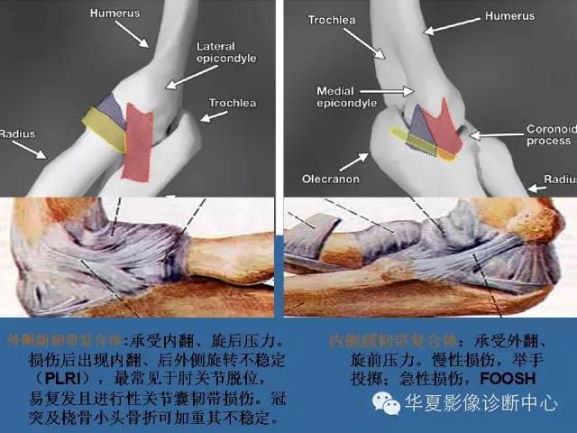 【PPT】肘关节外伤影像学评价