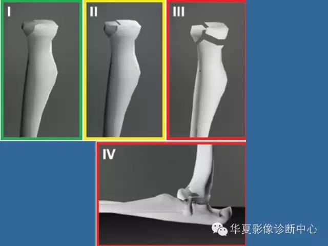 【PPT】肘关节外伤影像学评价