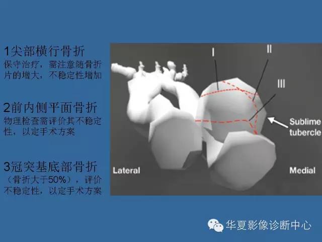 【PPT】肘关节外伤影像学评价