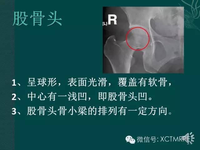 髋关节部分疾病影像学表现