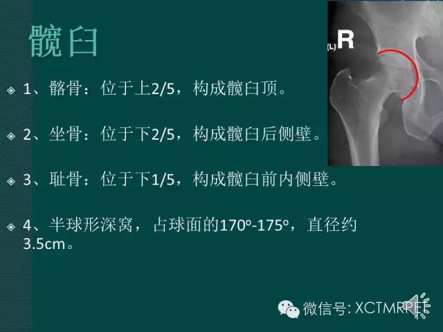 髋关节部分疾病影像学表现