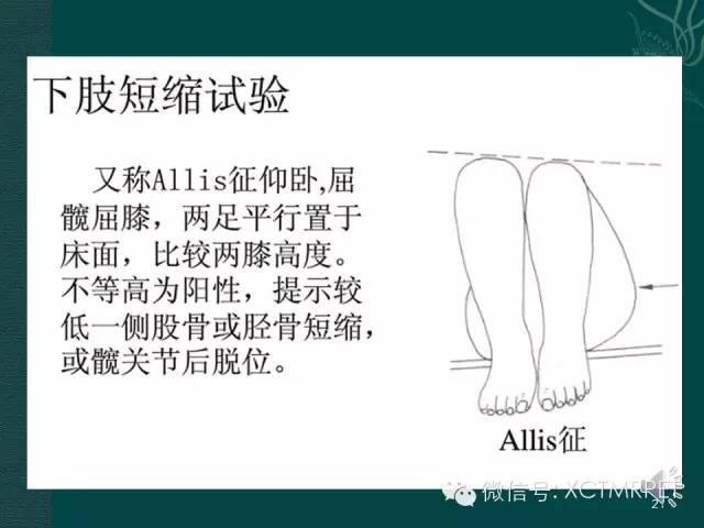 髋关节部分疾病影像学表现