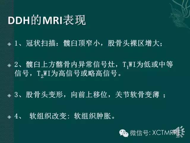 髋关节部分疾病影像学表现