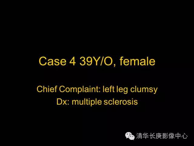 【病例】多发性硬化1例MR影像表现