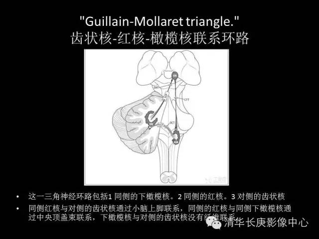 【病例】肥大性下橄榄核变性1例MR影像表现