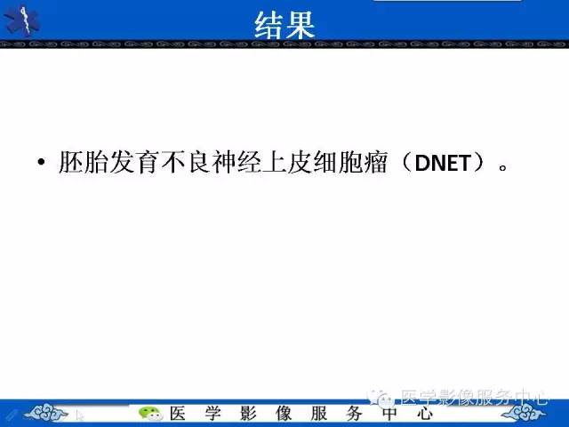 【病例】胚胎发育不良性神经上皮肿瘤DNET一例MR影像表现