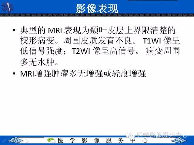 【病例】胚胎发育不良性神经上皮肿瘤DNET一例MR影像表现