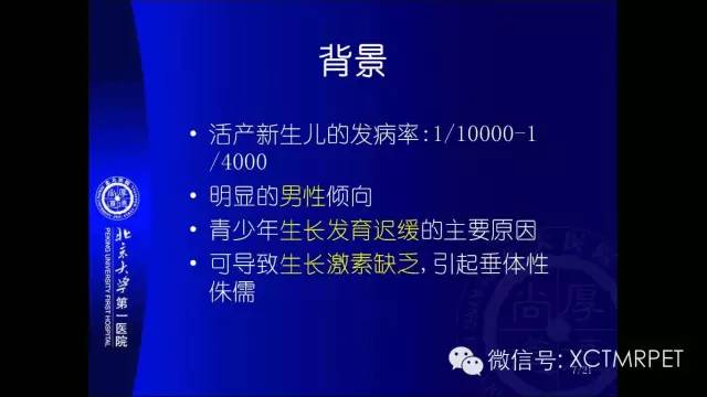 【PPT】垂体柄阻断综合征