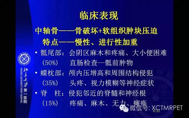 【PPT】脊索瘤