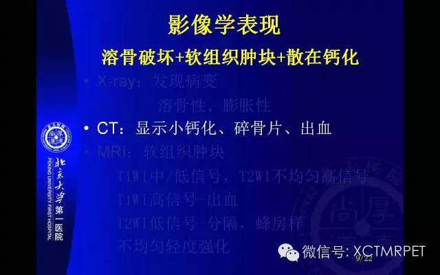 【PPT】脊索瘤