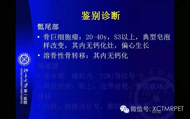 【PPT】脊索瘤