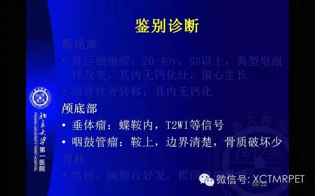 【PPT】脊索瘤
