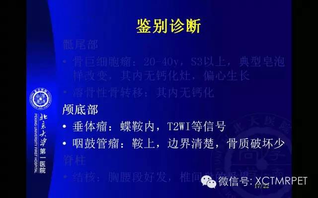 【PPT】脊索瘤