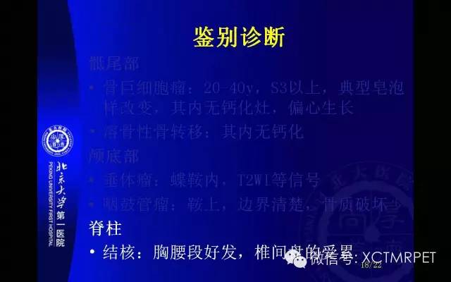 【PPT】脊索瘤