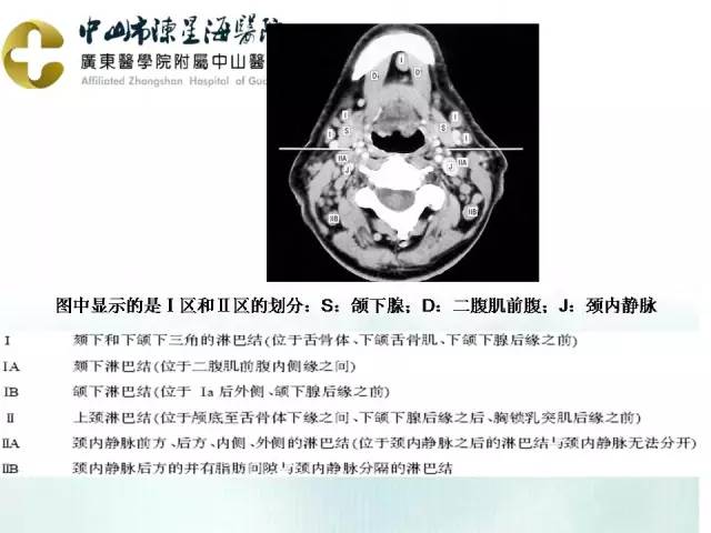 【PPT】甲状腺疾病CT诊断