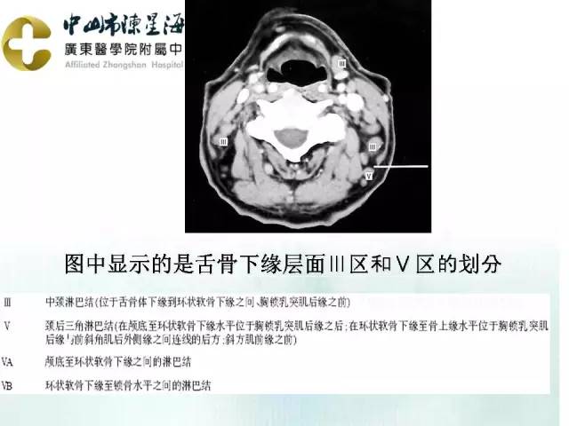 【PPT】甲状腺疾病CT诊断