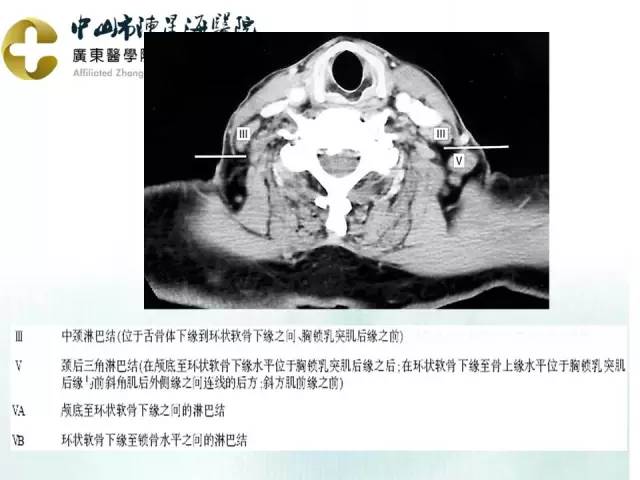 【PPT】甲状腺疾病CT诊断