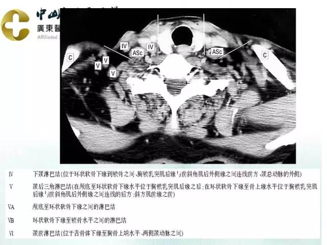 【PPT】甲状腺疾病CT诊断