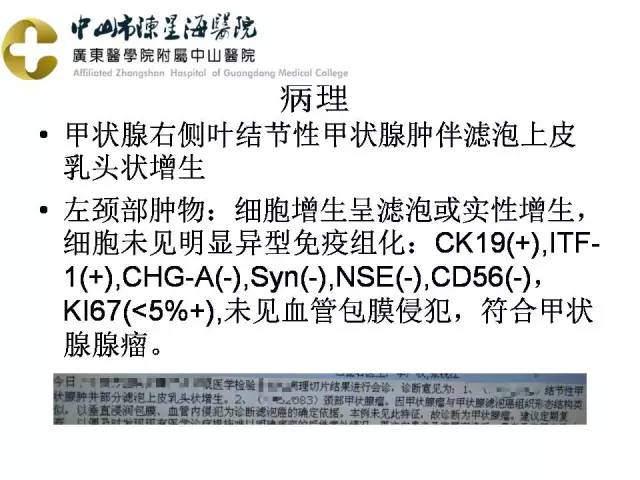 【PPT】甲状腺疾病CT诊断