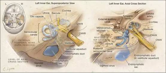 内淋巴囊肿瘤 Endolymphatic Sac Tumors，ELST