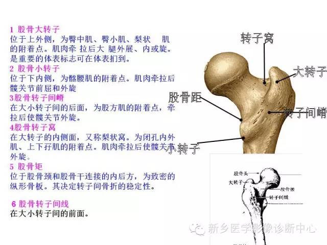 转子间骨折的分型和图解