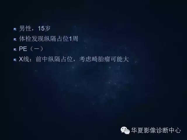 【病例】胸腺囊肿1例CT影像表现与鉴别