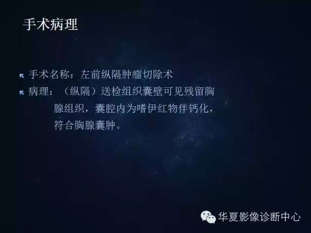 【病例】胸腺囊肿1例CT影像表现与鉴别