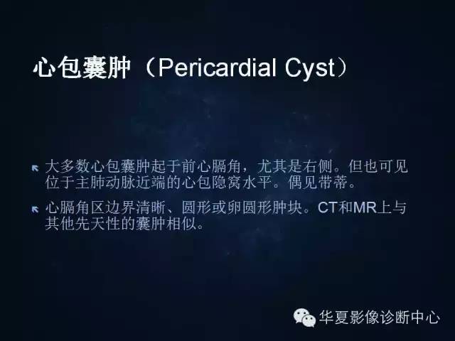 【病例】胸腺囊肿1例CT影像表现与鉴别