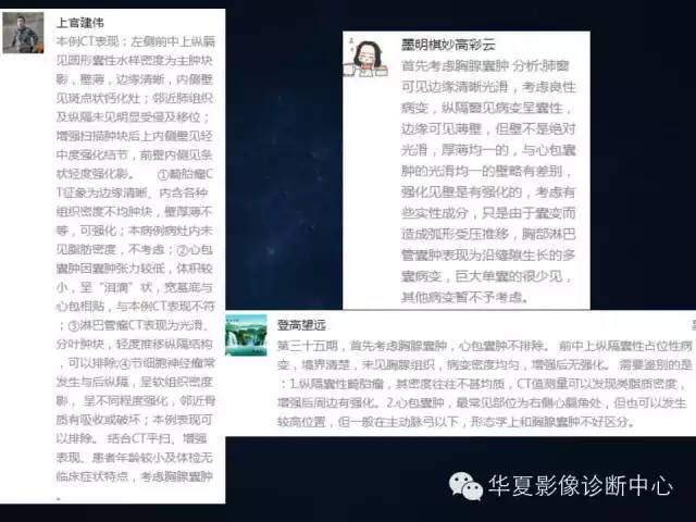 【病例】胸腺囊肿1例CT影像表现与鉴别