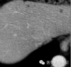 肝脏中体积小、特征不典型的病灶应该如何处理