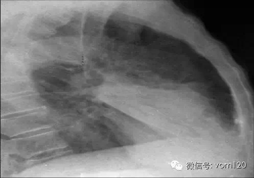 常见病例X线片