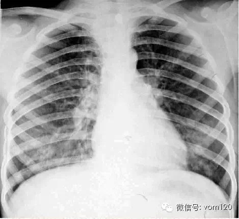 常见病例X线片