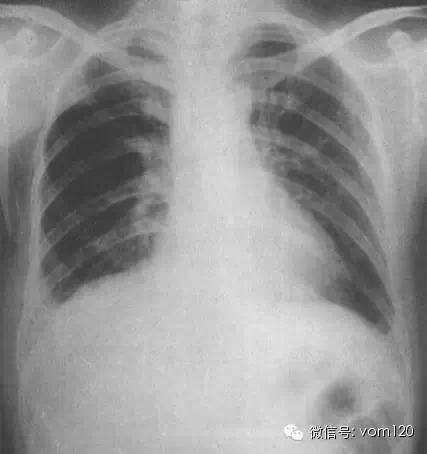 常见病例X线片