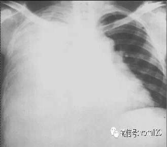 常见病例X线片