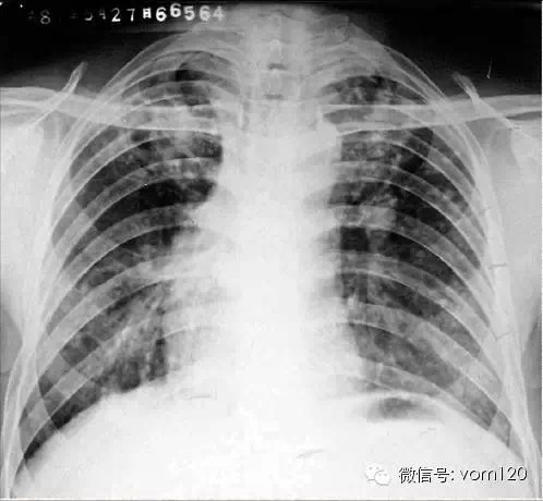 常见病例X线片