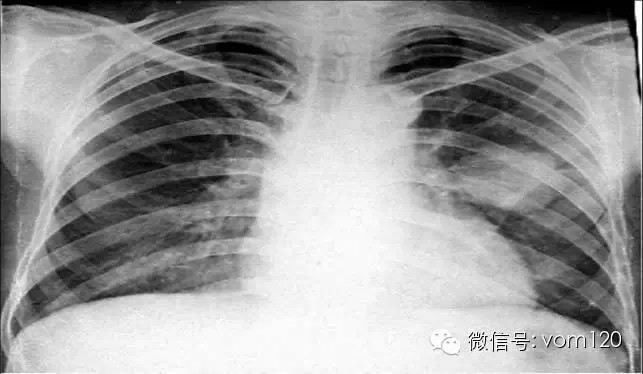 常见病例X线片