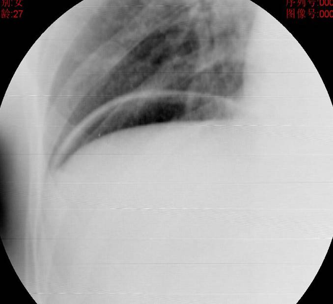 常见病例X线片