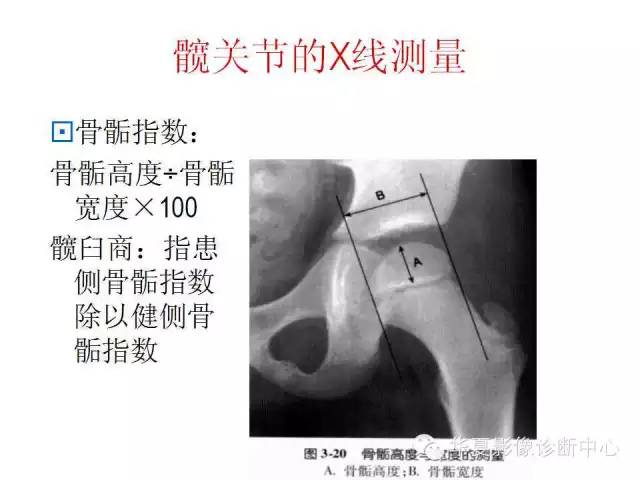髋关节X线测量方法