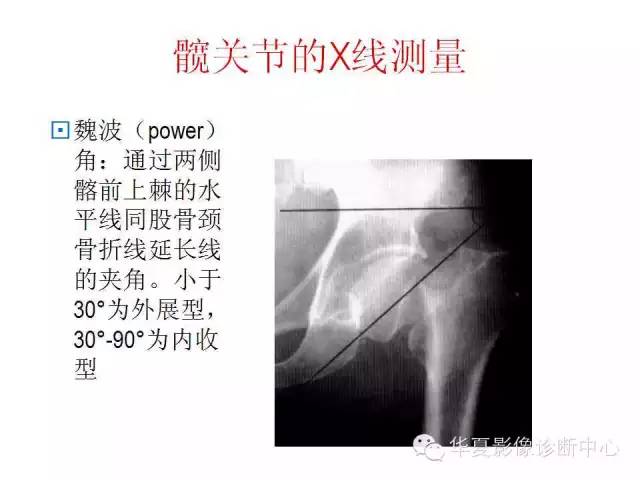 髋关节X线测量方法