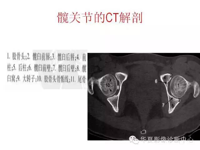 髋关节X线测量方法