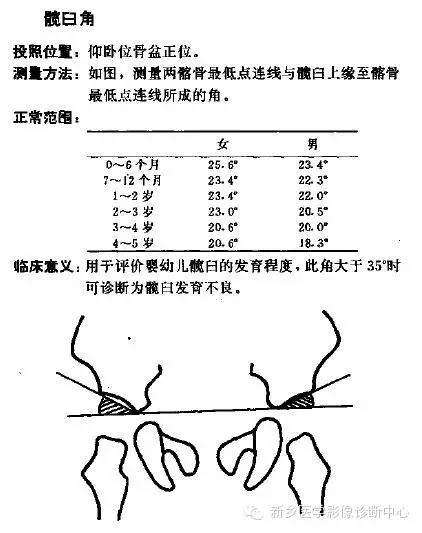 髋关节X线测量方法