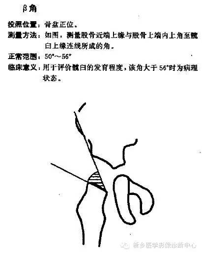 髋关节X线测量方法