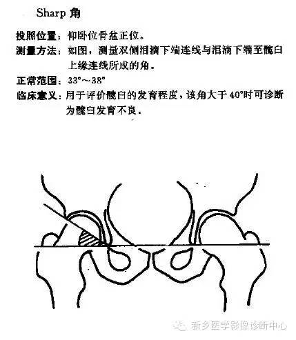髋关节X线测量方法