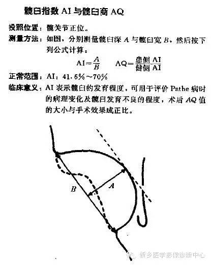 髋关节X线测量方法