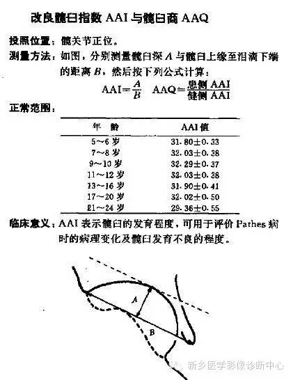髋关节X线测量方法