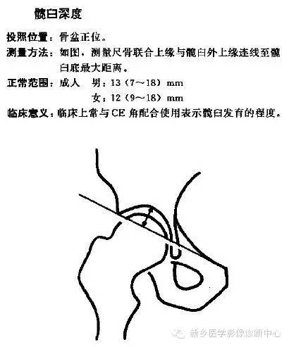 髋关节X线测量方法