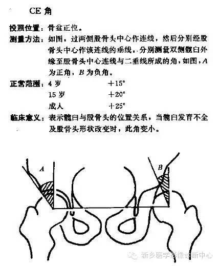 髋关节X线测量方法