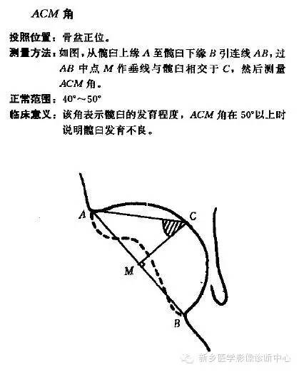髋关节X线测量方法