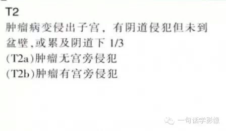 宫颈癌分期及图解